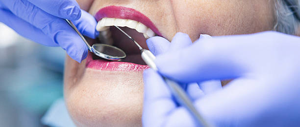 Best Emergency Dental Care for Broken or Chipped Teeth in Phillipsburg, KS